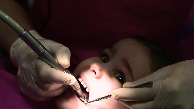 Treatment of baby teeth in a child, a doctor drills a tooth for caries.