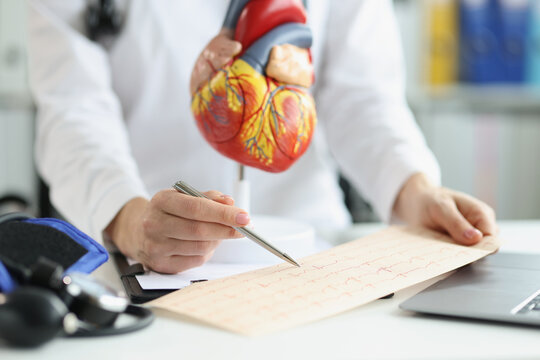 Plastic heart model, doctor examine electrogram result, professional diagnostic