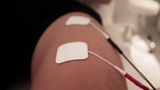 A closeup on attached electrodes to a human body, black and red wires. Physio therapy by electrical stimulation