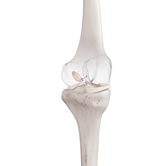 3d rendered medically accurate illustration of a torn anterior cruciate ligament