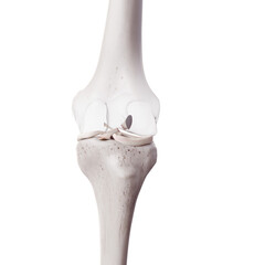 3d rendered medically accurate illustration of a torn anterior cruciate ligament