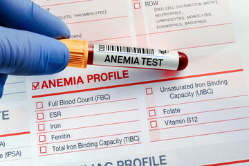 Doctor holding Blood tube test with requisition form for Anaemia test. Blood sample for analysis of...