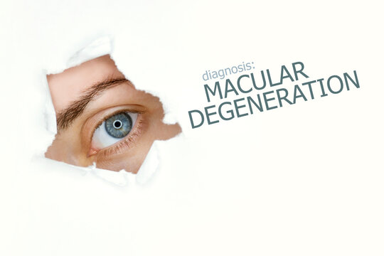 Macular degeneration disease poster with eye test chart and blue eye.Isolated on white