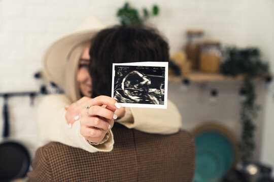 Happy couple hugging, caucasian woman holding ultrasound scan of her baby, focus on foreground. High quality photo