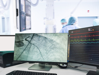 Modern Cath Lab showing LCD monitor with the doctor, nurse, and patient in the hospital, patient during treatment in Cath Lab Blurred of background.