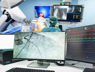 Coronary angiogram (CAG) on LCD monitor and Blurred of modern Cath Lab with the doctor, nurse, and...