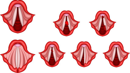 声帯　病気　構造