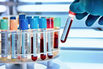 technician taking blood tubes in the laboratory centrifuge. hand of a doctor or nurse holds a blood...