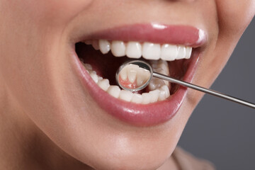 Examining woman's teeth with dentist's mirror on grey background, closeup