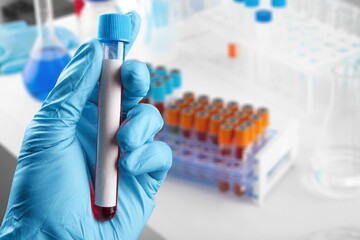 Omicron Variant on test tube, Covid 19 concept