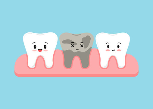 Cute teeth in gum with dead decay sad tooth kids dentistry sign isolated on blue background. Tooth row in jaw flat design kawaii cartoon style vector baby dental health illustration.