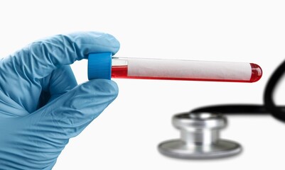Blood sample tube for variant of COVID-19 coronavirus test