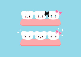 Cute teeth character before and after proximal decay in gym dental icon set isolated. Both tooth with interdental caries hole treatment concept. Flat cartoon dentistry clip art vector illustration