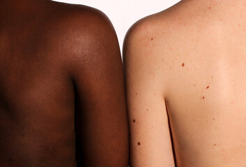 Dark-skinned should and a light-skinned shoulder together-racial equality concept