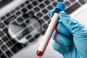 Blood sample tube on keyboard background