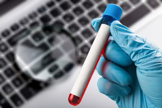 Blood sample tube on keyboard background
