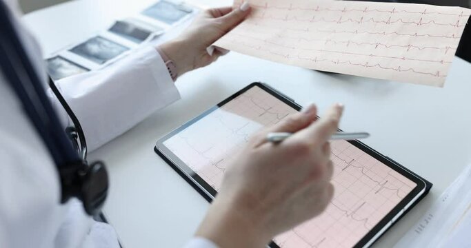 Cardiologist examines patient electrocardiogram on tablet