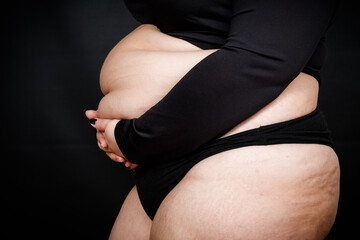 a woman holds her hands on a fat belly on a black background. obese person