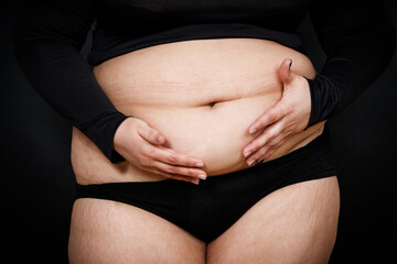 a woman holds with her hands folds of skin on a thick belly on a black background. obese person