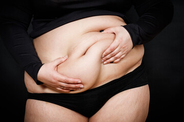 a woman holds her hands on a fat belly on a black background. obese person