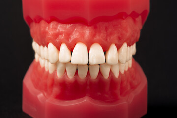 Closeup model with white teeth on black background. Jaw in dentistry. Clean denture, model of the jaw. Dental, oral surgery, stomatology, orthodontist concept
