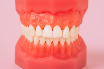 Closeup model with white teeth on pink background. Jaw in dentistry. Clean denture, model of the jaw. Dental, oral surgery, stomatology, orthodontist concept