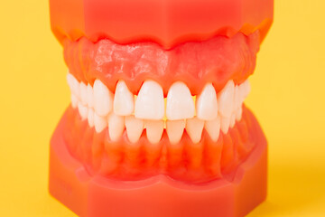 Closeup model with white teeth on yellow background. Jaw in dentistry. Clean denture, model of the jaw. Dental, oral surgery, stomatology, orthodontist concept