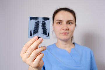 A doctor in a blue uniform shows a picture of a fluorogram of fluorography, an X-ray of the lungs...