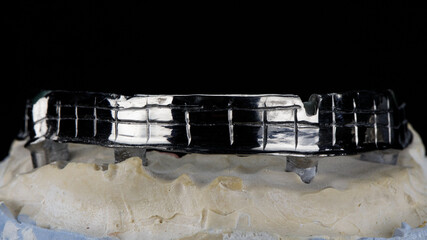 dental bar made of titanium for a prosthesis on a model with a black background