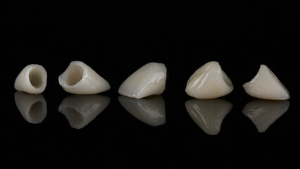 excellent dental crowns made of natural-colored ceramics on black glass with reflection