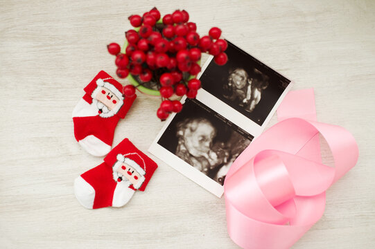 Ultrasound images lie next to children's Christmas socks and a pink ribbon