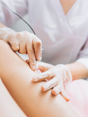 Obraz na płótnie Canvas Dermatologist doing hair removal treatment on patient's leg with electrolysis. Depilation and beauty concept, hands doing electro-epilation. Doctor working in cosmetic medical cabinet.