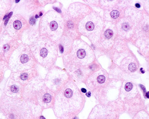 Human hepatocyte. Nucleolus