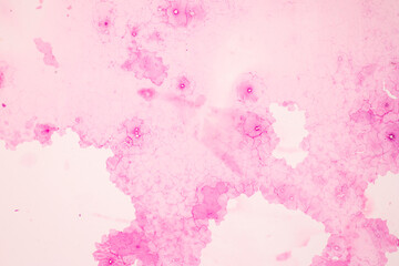 Anatomy and Histological Ovary, Testis and Sperm human cells under microscope.
