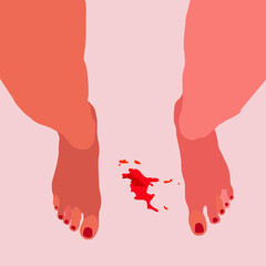 Girl's legs, bloodstain. Menstruation theme, period. Feminine hygiene.