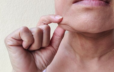 close up the fingers squeezing flabbiness skin beside the chin, problem flabby and hanging skin...