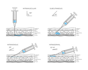 Types of injections. Guide to injecting vaccines into skin. Medical procedure manuals for hospital workers. Set vector illustration