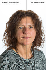 effects of sleep deprivation on a woman's face