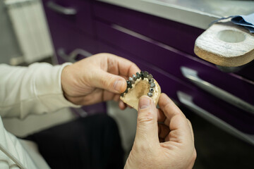 Part of a dental prosthesis manipulated by a worker. 