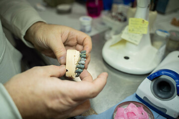 Unrecognizable person looking at a ceramic dental prosthesis in the workshop. 