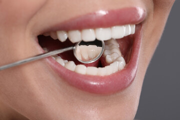 Fototapeta premium Examining woman's teeth with dentist's mirror on grey background, closeup