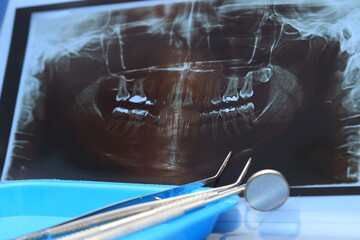 Panoramic radiography together with dental diagnostic instruments. Dental care concept © Carolina