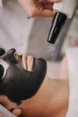 On the skin of the girl's face, gel with carbon was applied and black goggles were worn. The cosmetologist holds a laser in his hands and performs a carbon peeling procedure. 
