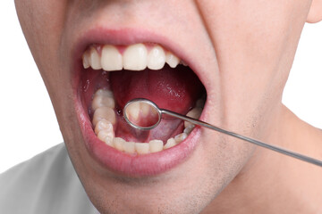Examining boy's teeth and gums with mirror on white background, closeup
