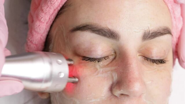 Cosmetologist making biolifting rf-lifting procedure. Rejuvenating skin, preventing aging, woman getting stimulating beauty facial treatment. hardware cosmetology in modern clinic. 4 k video