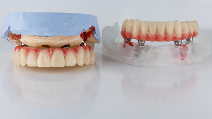 two dental prostheses of the upper and lower jaws and beams with artificial gums on a model with a white background and reflection