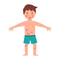 Boy Kids suffering from strong allergy skin itchy symptom in flat design. Red rash skin irritation.