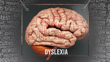 Dyslexia anatomy - its causes and effects projected on a human brain revealing Dyslexia complexity and relation to human mind. Concept art, 3d illustration - obrazy, fototapety, plakaty