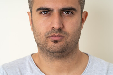 Obraz premium Close up photo of a man with uneven ear problem. Concept of otoplasty and ear surgery. Selective focus.