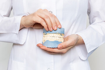 A plaster cast of teeth in the hands of doctor in a white coat isolated on a white background....